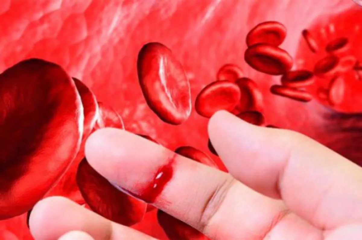 Алая пенистая кровь кровотечение. Гемофилия свертывание крови. Кровотечение при гемофилии.